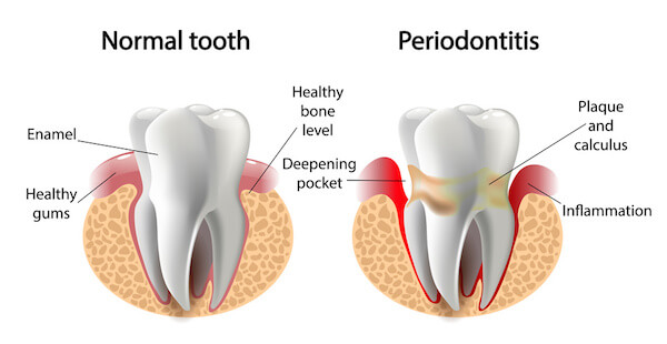 Periodontists